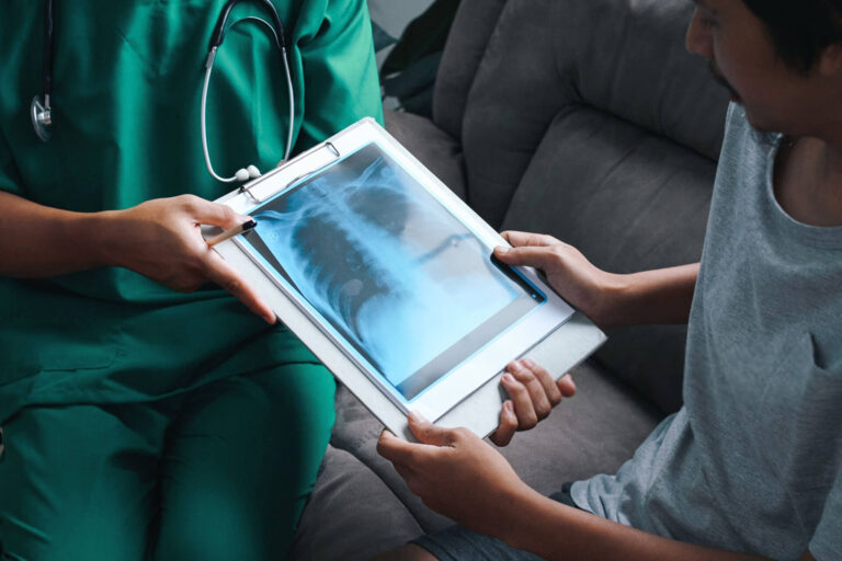 الأشعة المنزلية